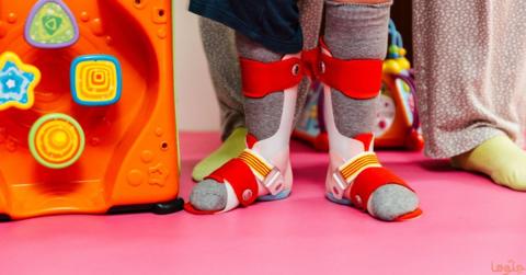 أسباب وعلاج تقوّس الساقين عند الأطفال وطرق
